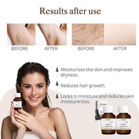 Thumbnail for Cyperus Rotundus Oil for Hair Removal 2 PACKS – 100% Pure Natural Cyprus Oil – Organic Herbal Cypress Root Extract for Smooth Skin, Reducing Body Hair Growth, Ingrown Hair & Nourishment – 60ml