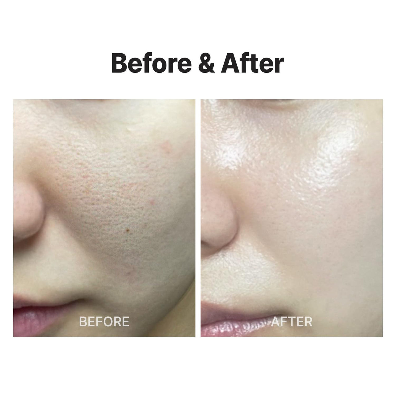 MEDITHERAPY Wrinklt-fit Mask(7EA), Collagen Mask, Lifting Sagging Skin, Hydrating & Firming, Smoothing Fine Lines, Improving Elasticity, Glass Skin, Korean Skincare