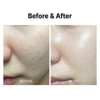 Thumbnail for MEDITHERAPY Wrinklt-fit Mask(7EA), Collagen Mask, Lifting Sagging Skin, Hydrating & Firming, Smoothing Fine Lines, Improving Elasticity, Glass Skin, Korean Skincare