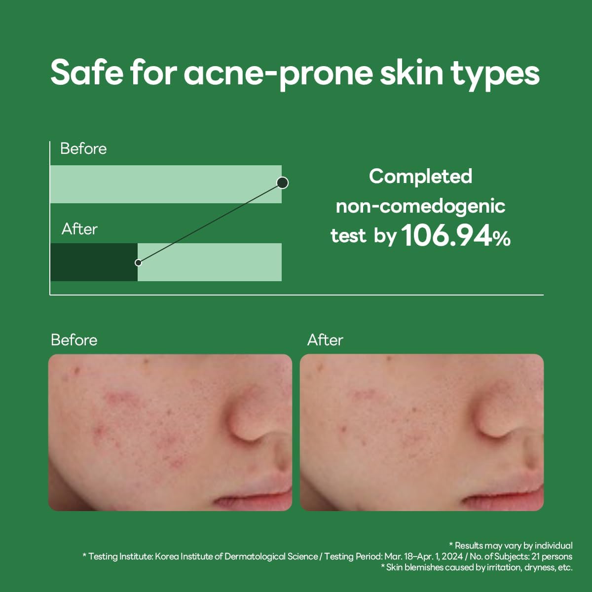 Mediheal Teatree Calming Serum 1.35 fl.oz - Skin Calming and Sebum Care & Deep Moisturization - with Hyaluronic Acid