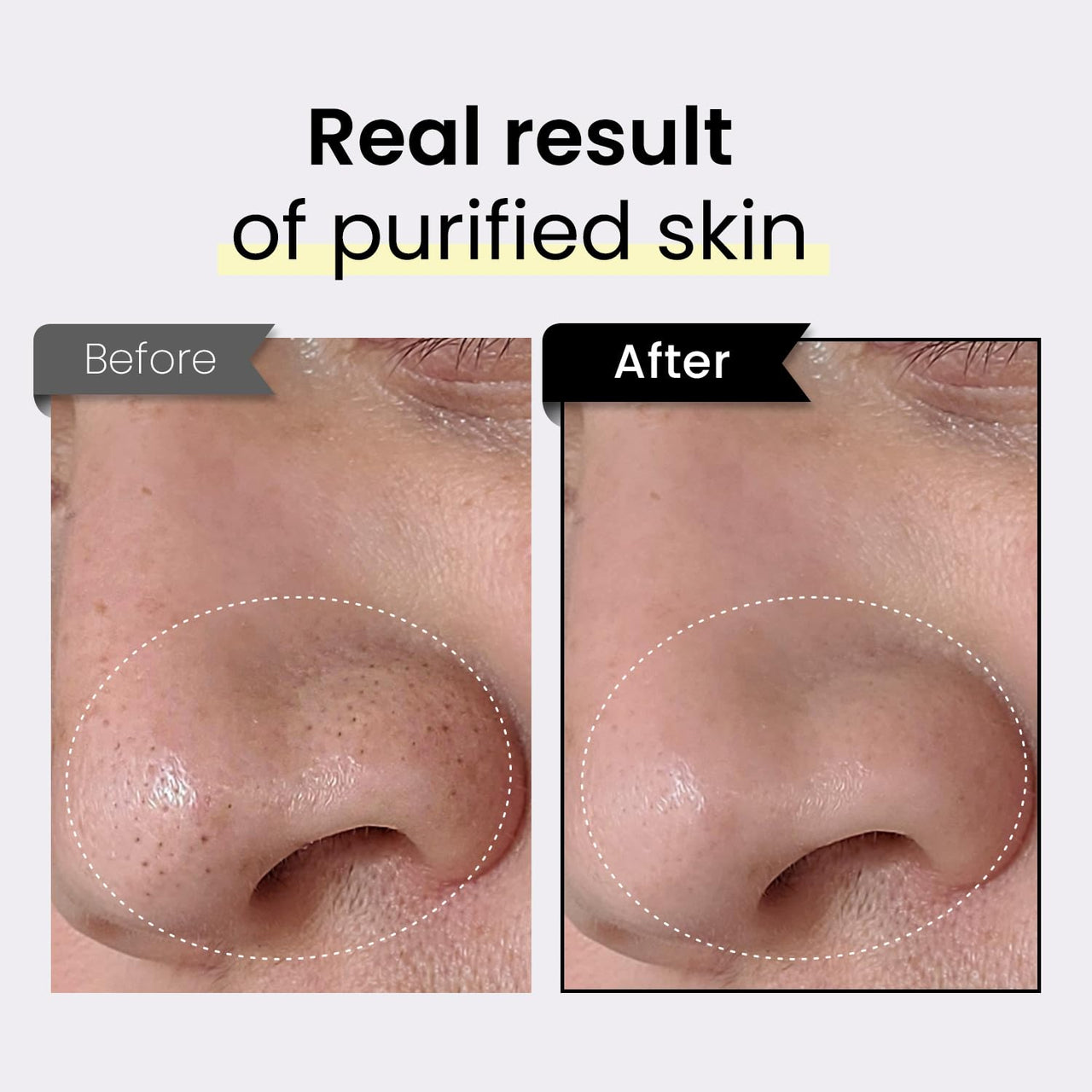 coxir BLACK RICE TXA PORE PURIFYING MASK l Tranexamic Acid, 3-in-1 Detox Serum Mask l Pore, Cleansing, Toning l Hydrating Wash Off Mask for Blackhead, Korean Skin Care[50ml/1.69 fl.oz]