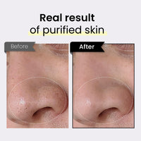 Thumbnail for coxir BLACK RICE TXA PORE PURIFYING MASK l Tranexamic Acid, 3-in-1 Detox Serum Mask l Pore, Cleansing, Toning l Hydrating Wash Off Mask for Blackhead, Korean Skin Care[50ml/1.69 fl.oz]