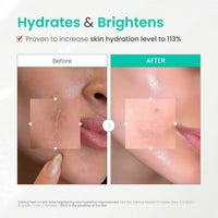 Thumbnail for Dr. G Brightening Peeling Gel - Korean Skincare for Glowy Skin - Aqua Gommage Facial Exfoliator - Hyaluronic Acid, Ceramides, Vitamin C - Smooth Skin Texture, Low Irritation - Bulk Items - 4.23 fl oz