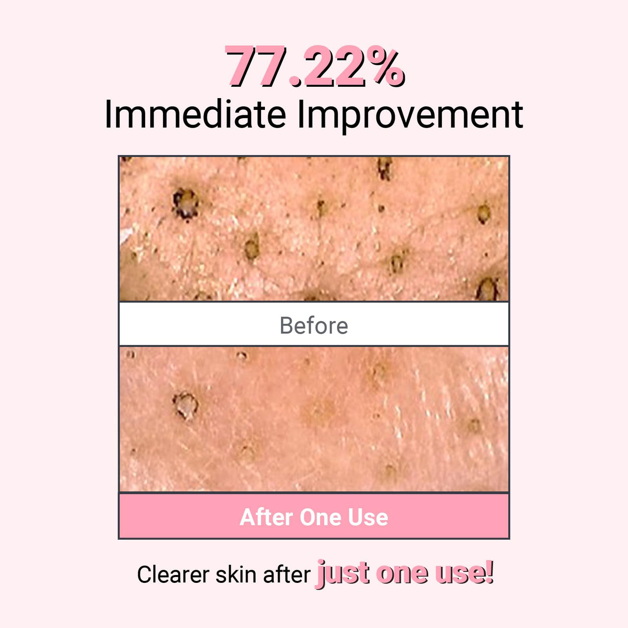 NEAF NEAF Kaolin Purifying Wash Off Pack, Pore Cleansing Mask for Dry Sensitive Skin, Softening and Hydrating, Korean Skincare (3.88oz / 110g)