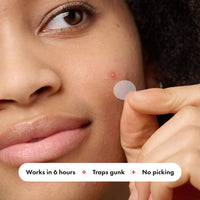 Thumbnail for Hero Cosmetics Mighty Patch™ Original Patch - Hydrocolloid Acne Pimple Patch for Covering Zits and Blemishes, Spot Stickers for Face and Skin (72 Count)