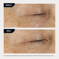 Thumbnail for Revision Skincare D·E·J Eye Cream®, Clinically Proven to Reduce Under-Eye Fine Lines and Wrinkles with Peptides and Hyaluronic Acid for a Firmer, Smoother Eye Area, 0.25 fl oz