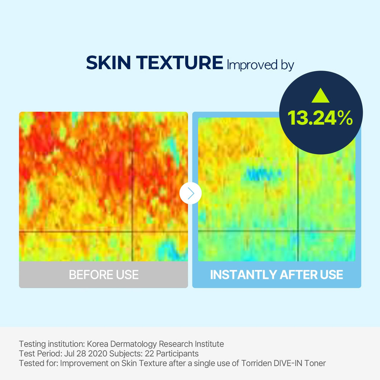Torriden Dive in Toner 300ml (10.14 fl. oz.) | pH Balancing Facial Toning Water for Dry Skin | Hyaluronic Acid, Panthenol, Allantoin