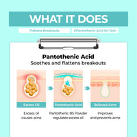 Thumbnail for numbuzin No.1 Powder | Pantothenic B5 Active Drying Powder | Spot Treatment Acne, Pantothenic Acid, Niacinamide, Madecassoside | Excess Oil Control, Flattens Cystic Acne, Breakouts | 0.24 oz.