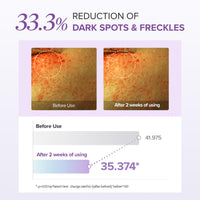 Thumbnail for Mary&May Tranexamic Acid + Glutathione Eye Cream (30ml) - Korean Skincare for Dark Circles & Uneven tone - Fragrance-Free Under Eye Cream for Dark Spots & Hyperpigmentation 1.01oz.