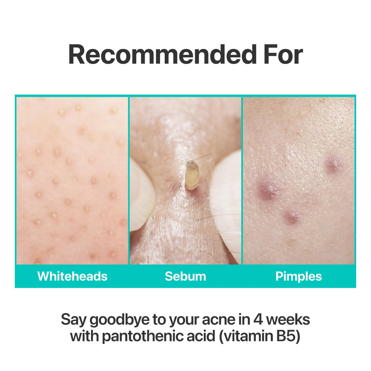 numbuzin No.1 Pantothenic B5 Active Soothing Cream | Remove sebum and skin troubles, Pantothenic acid, Korean Skincare Gift for Women | 2.70 fl oz