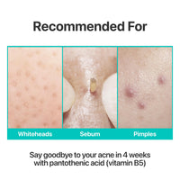 Thumbnail for numbuzin No.1 Pantothenic B5 Active Soothing Cream | Remove sebum and skin troubles, Pantothenic acid, Korean Skincare Gift for Women | 2.70 fl oz