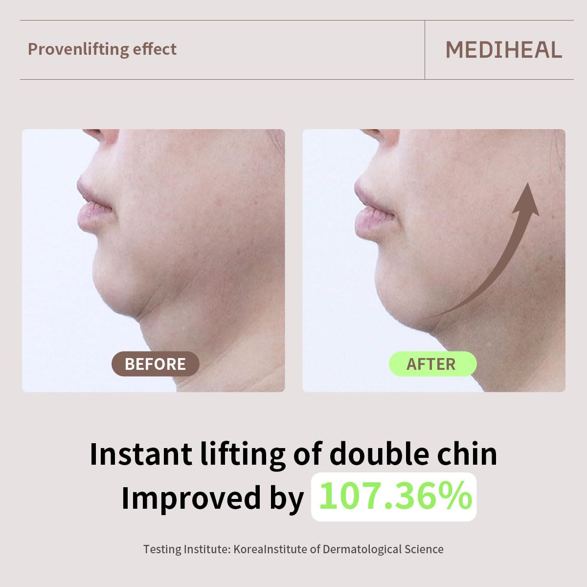 Mediheal Retinol Collagen Cream Lifting Mask (10 Counts) for V Line Mask, Anti-Aging - Helps Reduce Fine Lines & Wrinkles, and Smoothens Skin