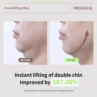 Thumbnail for Mediheal Retinol Collagen Cream Lifting Mask (10 Counts) for V Line Mask, Anti-Aging - Helps Reduce Fine Lines & Wrinkles, and Smoothens Skin