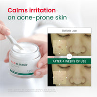 Thumbnail for Dr. G R.E.D. Blemish Clear Soothing Cream - Calming Korean Moisturizer for Redness - Soothes Acne & Irritation - With Centella Asiatica - Long-Lasting Hydration - 2.36 fl oz