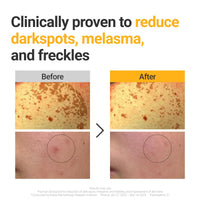 Thumbnail for ROVECTIN Vita Dark Spot Correcting Serum – Brightening Vitamin C & Niacinamide Serum for Glowing, Even Skin Tone | Vegan & Gentle Formula for Sensitive Skin | 1.01 Fl Oz (30 ml)