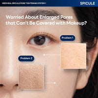 Thumbnail for Mediheal Collagen Spicule 1000ppm Intensive Serum – Micro Needle Serum for Pore Care, Soothing & Skin Texture Improvement, 2-Step,Collagen Spicule Ampoule and Gel Mask Set,Skin Booster,4pcs