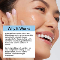 Thumbnail for CLEARSTEM - CELLRENEW - Collagen Stem Cell Serum - Acne + Youthful Skin Face Serum - Hyaluronic Acid, Reishi, Aloe Vera - Facial Skin Care Products - Gluten Free, Cruelty Free - 1 fl oz / 29ml
