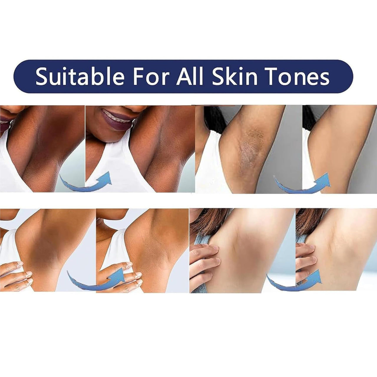 Vcetree Skin Bleaching Cream Skin Lightening for Body Intimate Areas, Private Parts, Underarm, Knees, Elbows, Inner Thigh, Bikini Area, Whitening Cream Dark Spot Remover For Intimate Areas (1FL OZ)