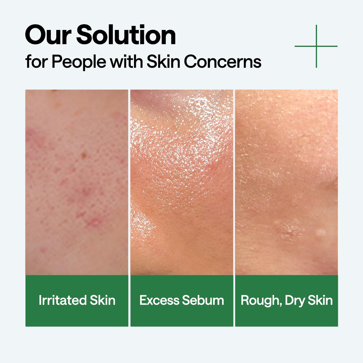 Mediheal Teatree Calming Serum 1.35 fl.oz - Quick Skin Calming and Redness Relief - Sebum Care, Oil Moisture Balance & Deep Moisturization with Hyaluronic Acid