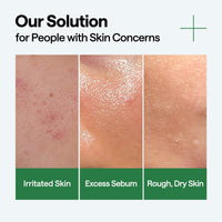 Thumbnail for Mediheal Teatree Calming Serum 1.35 fl.oz - Quick Skin Calming and Redness Relief - Sebum Care, Oil Moisture Balance & Deep Moisturization with Hyaluronic Acid