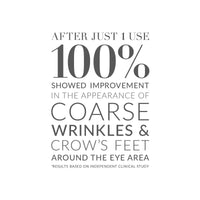 Thumbnail for Kate Somerville Retinol Firming Eye Cream – Anti-Aging Treatment Clinically Proven to Firm, Brighten and Smooth Lines and Wrinkles, 0.5 Fl Oz