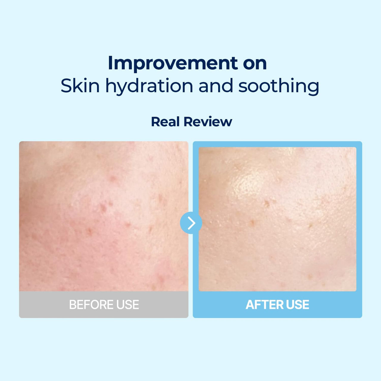 Torriden DIVE IN Multi Pad (80 pads) | Serum infused Facial Pads for Cooling, Soothing, Hydrating Spot Masking | Hyaluronic Acid, Panthenol, Allantoin