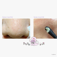 Thumbnail for ilso Natural Mild Clear Nose Patch, Melt blackheads & Tighten Pores, 10 sheets (Esther Bunny Acrylic Key ring included) (PINK Esther Bunny Limited Edition 10 sheets + Acrylic Key Ring)