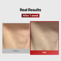 Thumbnail for Wrinkle-fit Neck Mask 7EA + Boosting Roller - Neck Wrinkle Patches, Firming and Tightening Korean Deep Collagen Mask - NeckTargeted Mesh Sheet Mask and Face Roller for Lifting Sagging Skin
