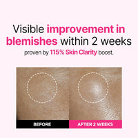 Thumbnail for ISOI Blemish Care Up Serum, Vegan Hydrating Serum for Smooth & Glass Skin Effect, Skin Barrier & Moisture Balance, Korean Skin Care (2.36 fl. oz, 70ml)