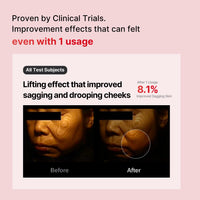 Thumbnail for Shumage Gold Seal Lifting Cream+Device - Moisturizer Face Lift Cream, Hydrating & Tightening for Sagging Skin - Korean Face Moisturizer - Microcurrent Facial Device for Radiant Glow Skin - 1.69 Fl. Oz