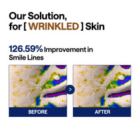 Thumbnail for MEDIHEAL Toner Pads [Retinol] - Collagen Lifting Pad for Skin Rejuvenation & Firming - Lifting Pads for Enhancing Skin Texture - Vegan Stretchable Lifting Fabric (100 Count)