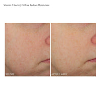 Thumbnail for Dr Dennis Gross VitC+Lactic Oil-Free Radiant Moisturizer, 1.7 fl oz/50ml