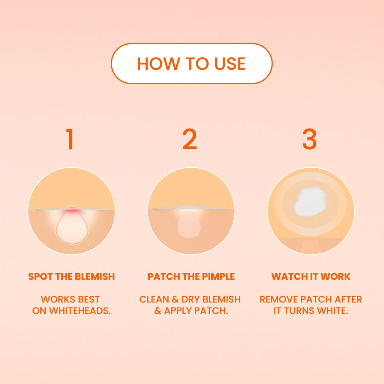 Bioré Pimple Patches, Cover & Conquer Blemish Patch, Medical Grade Ultra-Thin Hydrocolloid for Covering Zits and Blemishes, HSA/FSA Approved, 30 Count