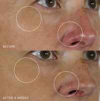 Thumbnail for Tatcha The Silk Serum Wrinkle-Smoothing Retinol Alternative | 30 ml / 1 oz