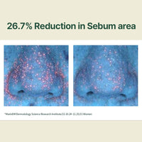 Thumbnail for Pyunkang Yul Calming Moisture Serum for Strong Daily Moisturizing Power, Skin Revival & Soothing Care with Centella Asiatica, Tea Tree, 5 Hyaluronic Acids, Ceramide |