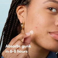 Thumbnail for Mighty Patch™ Invisible+ Patch – The Barely-There Daytime Hydrocolloid Acne Pimple Patch for Covering Zits and Blemishes, Tapered Edges Designed to Blend Into Skin (72ct)