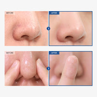 Thumbnail for TOSOWOONG AHA Blackhead Out Cleansing Oil, Jojoba Oil, Makeup Remover, Blackhead & Pore Cleaner, Gentle Face Cleanser, Korean Skincare, 150ml, 5.07 fl. oz.