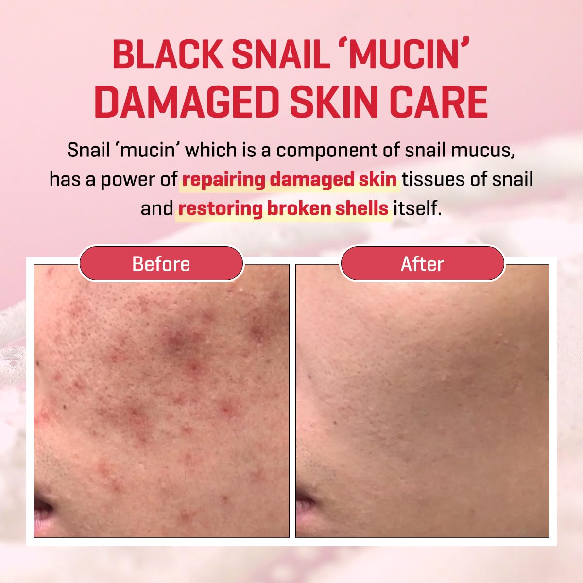 SOME BY MI Snail Trucica Miracle Repair Serum - 1.69Oz, 50ml - Made from Snail Mucin for Sensitive Skin - Daily Repair Face Serum for Post Acne Marks and Strengthen Skin Barrier - Korean Skin Care