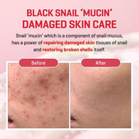 Thumbnail for SOME BY MI Snail Trucica Miracle Repair Serum - 1.69Oz, 50ml - Made from Snail Mucin for Sensitive Skin - Daily Repair Face Serum for Post Acne Marks and Strengthen Skin Barrier - Korean Skin Care