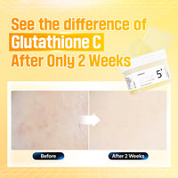 Thumbnail for numbuzin No.5 Toner Pads | Vitamin-Niacinamide Concentrated Pad | Double-Sided | Glutathione, Niacinamide, PHA & LHA | Exfoliation, Hyperpigmentation Care | 70 Pads/180 ml
