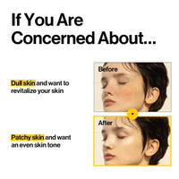 Thumbnail for d'alba Piedmont White Truffle Oil Capsule Serum, Daily Vita Boost for Luminous Skin, Double Vitamin Formula (3.38fl. oz.)