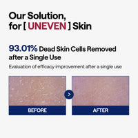 Thumbnail for MEDIHEAL Phyto Enzyme Peeling Pad - Vegan Face Resurfacing Gauze Pads with LHA & Papaya Enzym - Pore Tightening Pads to Control Sebum - Exfoliating Pads for Dead Skin Cells, 90 Pads