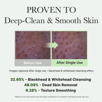 Thumbnail for Arencia Korean Rice Mochi Face Cleanser - Face Wash, Gentle Scrub All in One for Deep Cleansing, Moisturizing, Pore Minimizing, Acne-Prone Skin, Removing Blackhead with Rice Water & Green Tea
