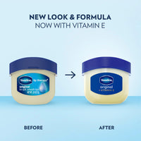 Thumbnail for Vaseline Lip Therapy 4 Twin Packs (8 Jars Total) – Mini Lip Balm for Healing Dry Lips, Travel-Size Petroleum Jelly Lip Care, 0.25 Oz Each