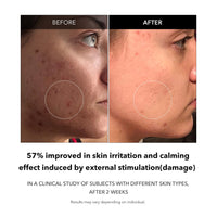 Thumbnail for APRILSKIN Carrotene Clarifying Facial Serum | Vegan, Non-comedogenic | Blemish Clear, Dark Spot Corrector | Korea Skincare | Oily Skin, Sensitive Skin, Bumpy Skin | 1.25 fl.oz