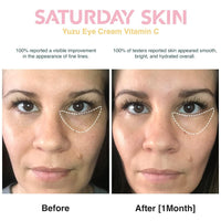 Thumbnail for Saturday Skin Yuzu Eye Balm Vitamin C Wide lluminating Under Tight Eye Cream Korean Niacinamide Caffeine for Wrinkles Puffy Eyes Dark Circles Moisturizing Hydrates Anti Aging for Women (15ml)