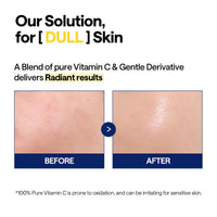 Thumbnail for MEDIHEAL Vitamin C Brightening Serum (1.35 fl oz, 1 Pack) - Tone-Texture-Glow Care, Manage Skin with Vitamin C, Niacinamide, Hyaluronic Acid