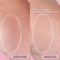 Thumbnail for SOL DE JANEIRO Collagen Boosting Biggie Biggie Beija Flor Elasti-Cream | Jumbo Size Body Cream 500ml