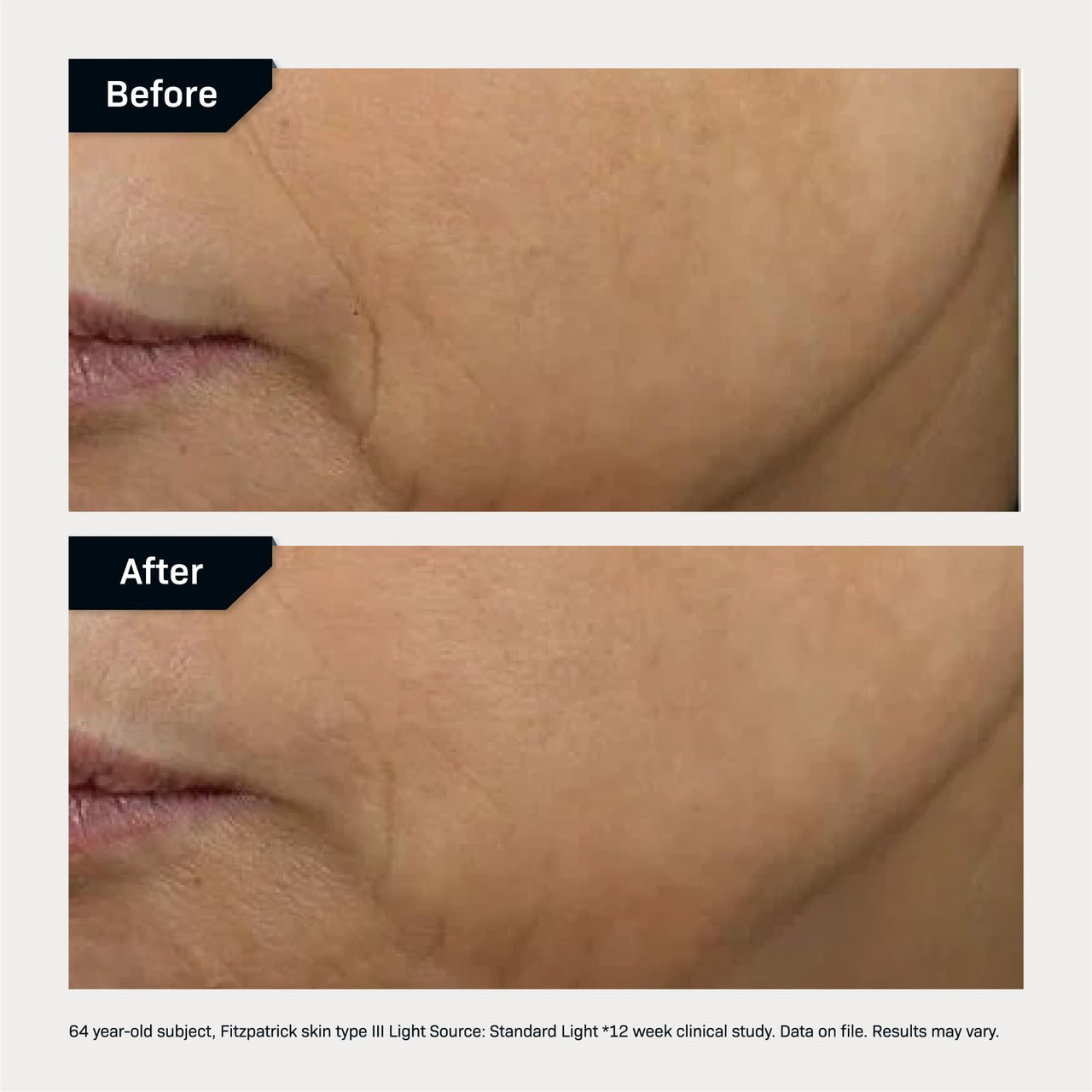 Revision Skincare D·E·J Face Cream®, Advanced Anti Aging Moisturizer, Lifting and Firming, Antioxidant Rich, 1.7 oz