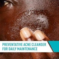 Thumbnail for CeraVe Acne Treatment Face Wash, Salicylic Acid Cleanser with Purifying Clay, Niacinamide, and Ceramides, Pore Control and Blackhead Remover, 8 Ounce